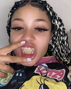 UPDATED! Coi Leray Teeth Fixed Before and After 2023