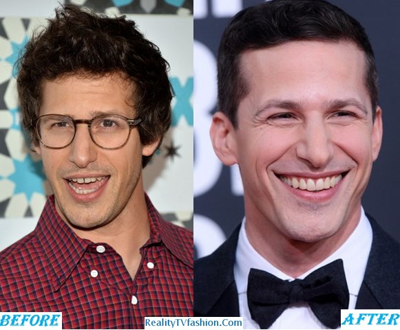 Andy Samberg Teeth