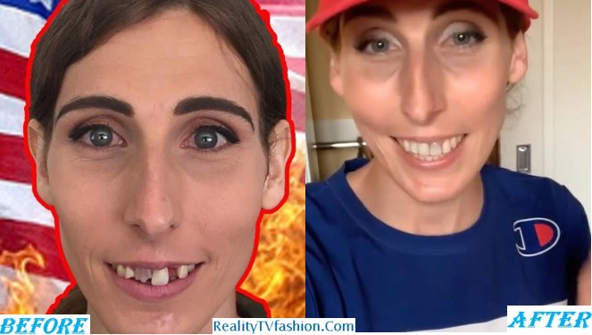 Chelsea Wolfe Teeth Before After