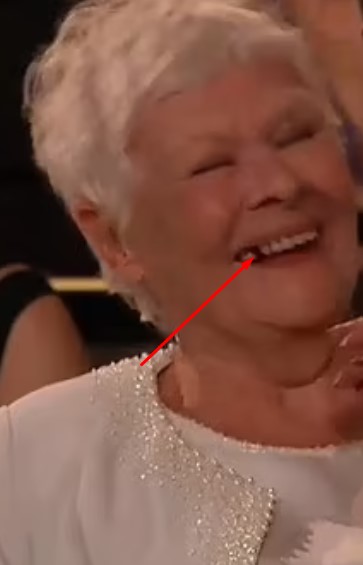 Judi Dench Missing Teeth