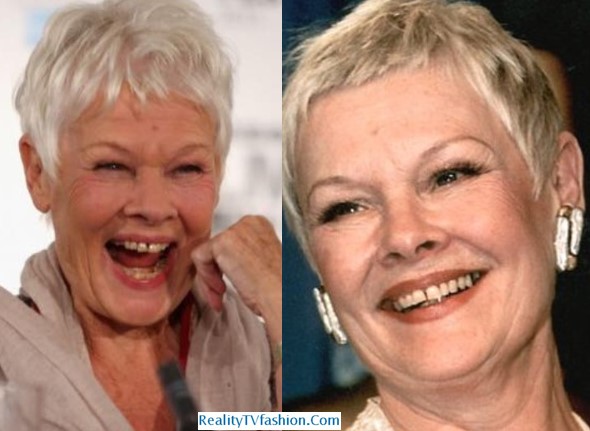 Judi Dench Teeth