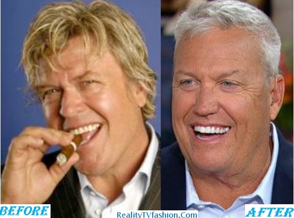 Rex Ryan Teeth