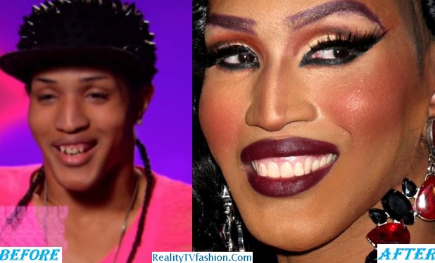 Trinity K Bonet Teeth