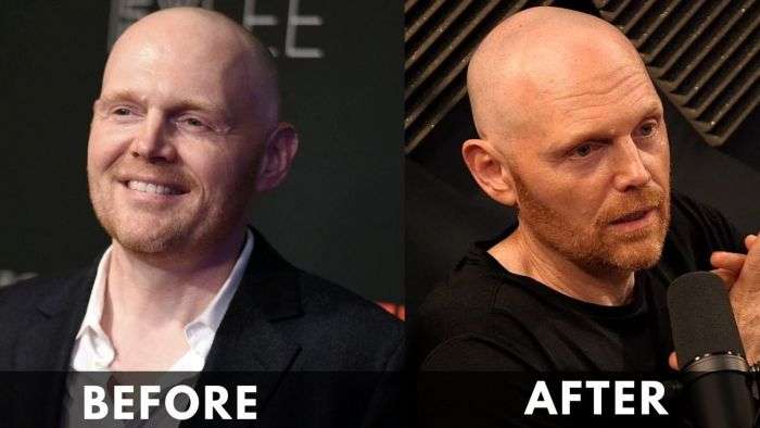 Bill Burr Weight Loss Before After Tranformation 2023